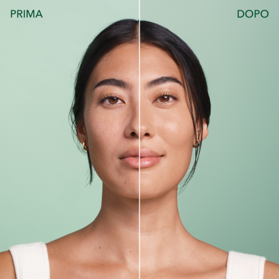 PRIMA DOPO